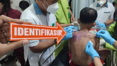Aktivis Kontras Jadi Korban Penyiraman Air Keras, DPR Minta Penyelidikan Tuntas