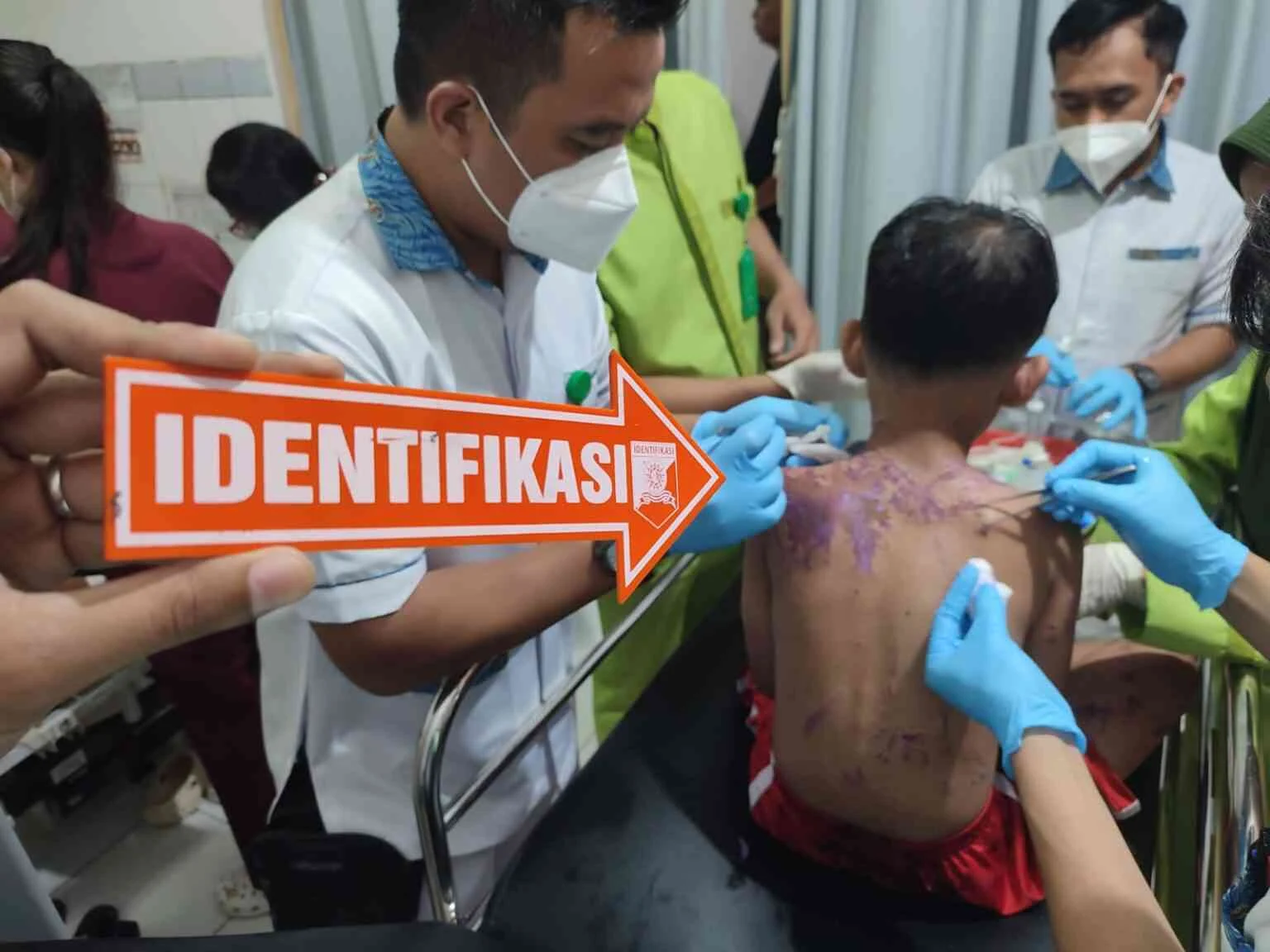 Aktivis Kontras Jadi Korban Penyiraman Air Keras, DPR Minta Penyelidikan Tuntas