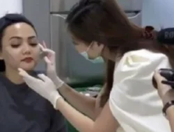 Hidung Baru Rina Nose: Transformasi Dramatik Usai Operasi di Klinik Dr. Tompi Bikin Netizen Terkagum
