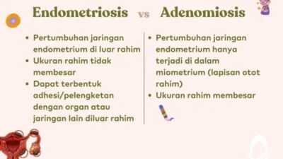 Waspada! Ini Bedanya Nyeri Haid Biasa dengan Tanda Endometriosis yang Harus Kamu Ketahui