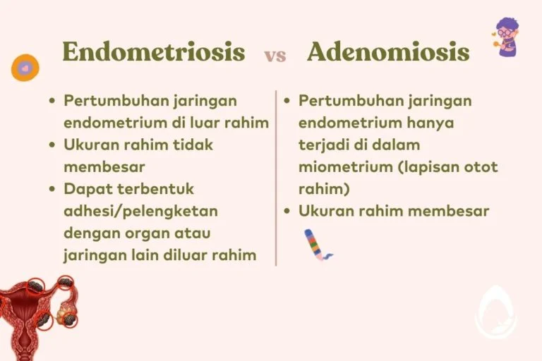 Waspada! Ini Bedanya Nyeri Haid Biasa dengan Tanda Endometriosis yang Harus Kamu Ketahui