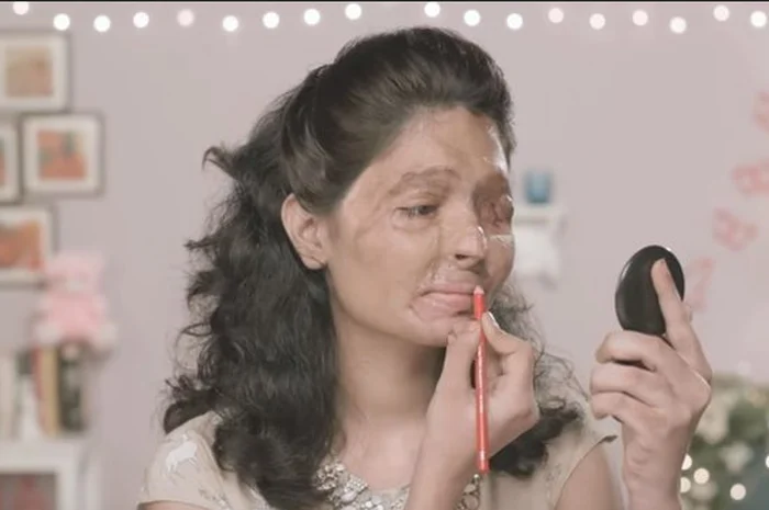 Operasi Intelijen: Menguak Jejak Penyiraman Air Keras yang Mengguncang Aktivis KontraS