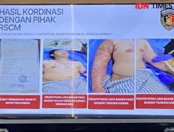 Hakim Uji Penglihatan Terdakwa Kasus Andrie Yunus Usai Mengaku Terkena Cipratan Air Keras