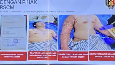 Hakim Uji Penglihatan Terdakwa Kasus Andrie Yunus Usai Mengaku Terkena Cipratan Air Keras