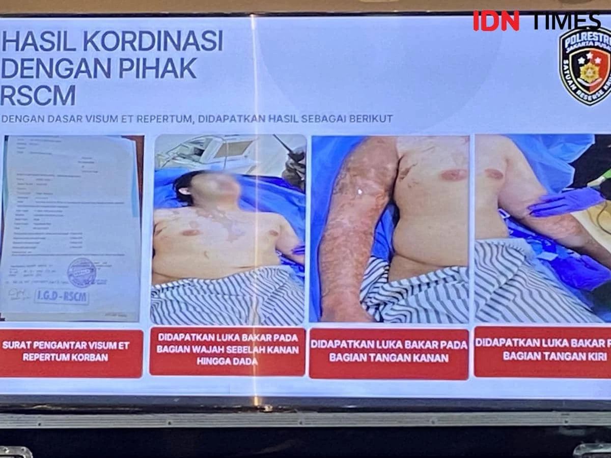 Hakim Uji Penglihatan Terdakwa Kasus Andrie Yunus Usai Mengaku Terkena Cipratan Air Keras