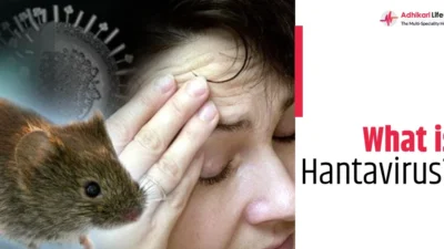 Hantavirus: Risiko yang Ditipu dan Fakta yang Harus Anda Ketahui